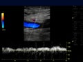 Ultrasound doppler of femoral vien. Royalty Free Stock Photo