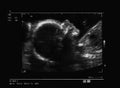 Ultrasound of a fetus at 26 weeks Royalty Free Stock Photo