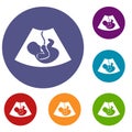 Ultrasound fetus icons set