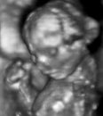 An ultrasound of a human fetus during the 16th week