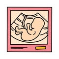Ultrasound image with an embryo baby, pregnancy scan Royalty Free Stock Photo