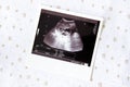 Ultrasound image for pregnancy Royalty Free Stock Photo