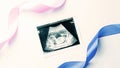 Ultrasound image pregnant baby photo. Blue, pink ribbon with ultrasound pregnancy picture on white background. Concept Royalty Free Stock Photo