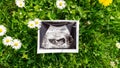 Ultrasound image pregnant baby photo. Ultrasound pregnancy picture on grass flowers background. Concept of pregnancy