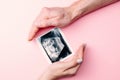 Ultrasound image pregnant baby photo. Woman hands holding ultrasound pregnancy picture on pink background. Pregnancy