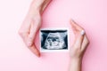 Ultrasound image pregnant baby photo. Woman hands holding ultrasound pregnancy picture on pink background. Pregnancy