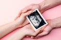 Ultrasound image pregnant baby photo. Woman hands holding ultrasound pregnancy picture on pink background. Pregnancy