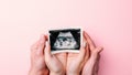 Ultrasound image pregnant baby photo. Woman hands holding ultrasound pregnancy picture on pink background. Pregnancy