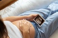 Ultrasound image pregnant baby photo. Woman holding ultrasound pregnancy picture. Pregnancy, medicine, pharmaceutics