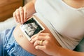 Ultrasound image pregnant baby photo. Woman holding ultrasound pregnancy picture. Pregnancy, medicine, pharmaceutics