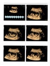 Ultrasound images of 13 weeks pregnant show baby or fetus development and pregnancy health checking Royalty Free Stock Photo