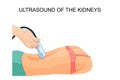 Ultrasound of the kidneys Royalty Free Stock Photo