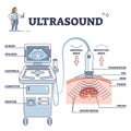 Ultrasound patient analysis process and equipment explanation outline diagram