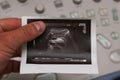 Ultrasound photo - pancreas tumor