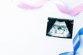 Ultrasound photo pregnancy baby. Blue, pink ribbon with ultrasound pregnancy picture on white background. Concept Royalty Free Stock Photo