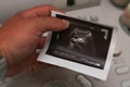 ultrasound photo - small pancreas tumor