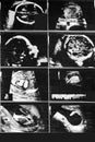 ultrasound picture baby memory photography Royalty Free Stock Photo