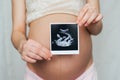 Ultrasound picture in the hands of a pregnant girl