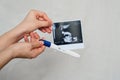 Ultrasound picture and positive pregnancy test in the hands of a girl Royalty Free Stock Photo