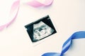 Ultrasound picture pregnant baby photo. Blue, pink ribbon with ultrasound pregnancy image on white background. Pregnancy Royalty Free Stock Photo