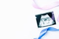 Ultrasound picture pregnant baby photo. Blue, pink ribbon with ultrasound pregnancy image on white background. Pregnancy Royalty Free Stock Photo