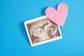 Ultrasound picture pregnant baby photo and envelope on blue background Royalty Free Stock Photo