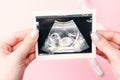 Ultrasound picture pregnant baby photo. Woman hands holding ultrasound pregnancy image on pink background. Concept of Royalty Free Stock Photo