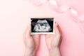Ultrasound picture pregnant baby photo. Woman hands holding ultrasound pregnancy image on pink background. Concept of Royalty Free Stock Photo