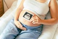 Ultrasound picture pregnant baby photo. Woman holding ultrasound pregnancy image. Concept of pregnancy, maternity Royalty Free Stock Photo