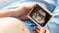 Ultrasound picture pregnant baby photo. Woman holding ultrasound pregnancy image. Concept of pregnancy, maternity Royalty Free Stock Photo