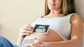 Ultrasound picture pregnant baby photo. Woman holding ultrasound pregnancy image. Concept of pregnancy, maternity Royalty Free Stock Photo