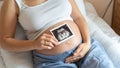 Ultrasound picture pregnant baby photo. Woman holding ultrasound pregnancy image. Concept of pregnancy, maternity Royalty Free Stock Photo