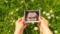 Ultrasound picture pregnant baby photo. Woman holding ultrasound pregnancy image on grass flower background. Concept of Royalty Free Stock Photo