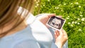 Ultrasound picture pregnant baby photo. Woman holding ultrasound pregnancy image on grass flower background. Concept of Royalty Free Stock Photo