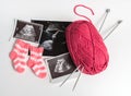 Ultrasound pictures and knitting shoes for baby girl