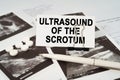 On the ultrasound pictures there is a pen and a business card with the inscription - Ultrasound of the scrotum Royalty Free Stock Photo