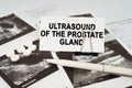 On the ultrasound pictures there is a pen and a business card with the inscription - Ultrasound of the prostate gland