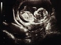 Ultrasound pregnancy Royalty Free Stock Photo