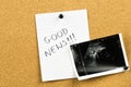 Ultrasound pregnancy photo on cork board. Baby fetus photo as a first pregnancy sticky note Royalty Free Stock Photo