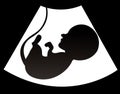 Ultrasound pregnancy, ultrasound of baby in mother womb vector illustration