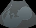 Ultrasound pregnancy, ultrasound of baby in mother womb vector illustration