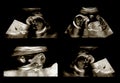 Ultrasound of pregnant woman to see her tiny baby in mother belly.Ultrasound scanning monitor an unborn baby in pregnant woman. Royalty Free Stock Photo