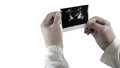 Ultrasound of the prostate at the doctor`s hands, a picture of a male prostate, on a white background