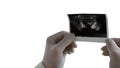 Ultrasound of the prostate in the hands of a doctor, a picture of a male prostate Royalty Free Stock Photo