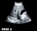 Ultrasound research film. Male abdominal cavity examination