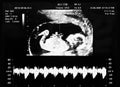 Ultrasound scan Royalty Free Stock Photo