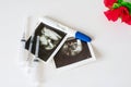 Ultrasound scan of baby and pregnancy test on white background Royalty Free Stock Photo