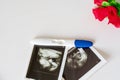 Ultrasound scan of baby and pregnancy test on white background Royalty Free Stock Photo