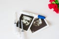 Ultrasound scan of baby and pregnancy test on white background Royalty Free Stock Photo