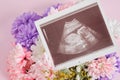 Ultrasound scan and flowers on pink background pregnancy and motherhood concept, conscious parenthood